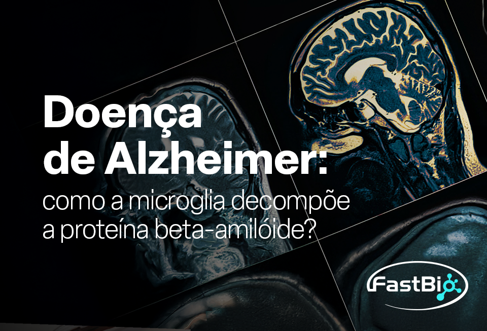 Doença de Alzheimer: como a microglia decompõe a proteína beta-amilóide?