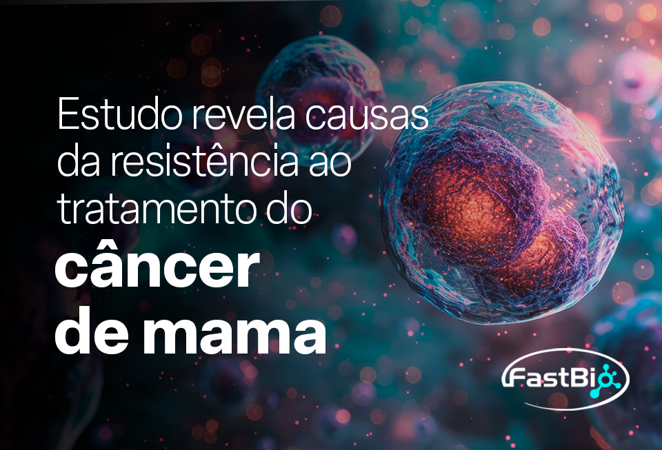 Estudo revela causas da resistência ao tratamento do câncer de mama